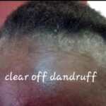 Hair Growth Oil, hair salon near me, braiding salons near me, hair braiding near me, african hair braiding near me, natural hair salons near me, braids near me, 3
